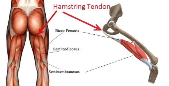 Hamstring Tendon Pain